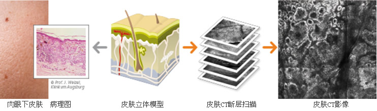 皮肤CT--福建省首台　皮肤科医生第三只眼　病灶从此“无处藏身”