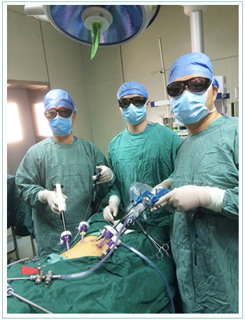 胃肠外科一区践行改善医疗服务行动计划成功为患者开展3D完全腹腔镜下根治性远端胃切除术+uncut Roux-en-Y吻合术