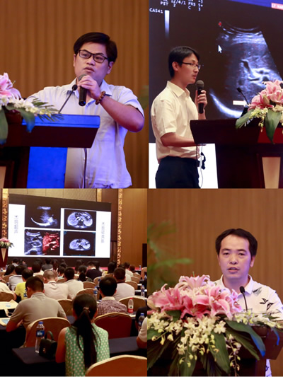 我院超声影像科举办首届介入超声沙龙