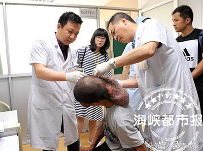 “顶着‘墨鱼脑袋’靠触觉生活22年”追踪--闽清小伙彻底告别“墨鱼头” “顶着‘墨鱼脑袋’靠触觉生活22年”追踪--闽清小伙彻底告别“墨鱼头”