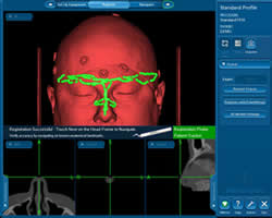 我院耳鼻咽喉科引进国际最先进的专科电磁导航系统助力精准耳鼻颅底手术 我院耳鼻咽喉科引进国际最先进的专科电磁导航系统助力精准耳鼻颅底手术