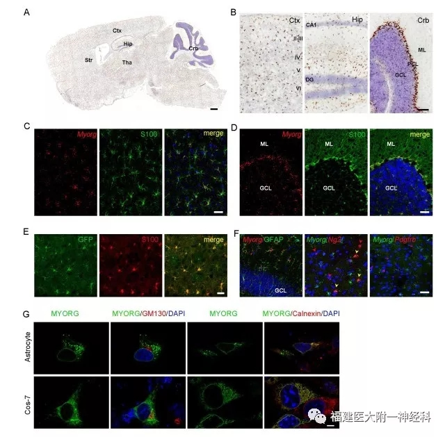 国际神经科学领域顶级期刊“Neuron”发表我院陈万金团队最新研究成果——发现原发性家族性脑钙化症首个隐性遗传致病基因 国际神经科学领域顶级期刊“Neuron”发表我院陈万金团队最新研究成果——发现原发性家族性脑钙化症首个隐性遗传致病基因