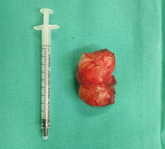 勇担重任  拆除“炸弹”——中央电视台中文国际频道《华人世界》栏目专题报道我院援博茨瓦纳医疗队员陈希杭的先进事迹