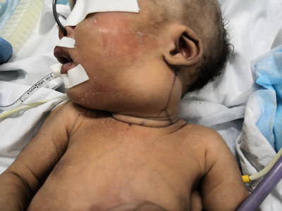 勇担重任  拆除“炸弹”——中央电视台中文国际频道《华人世界》栏目专题报道我院援博茨瓦纳医疗队员陈希杭的先进事迹