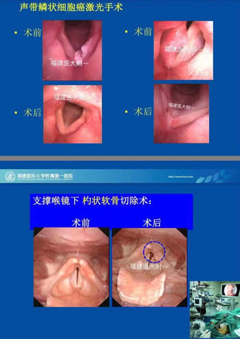 我院耳鼻咽喉科入选中国医师协会（鼻科+咽喉科）内镜培训基地