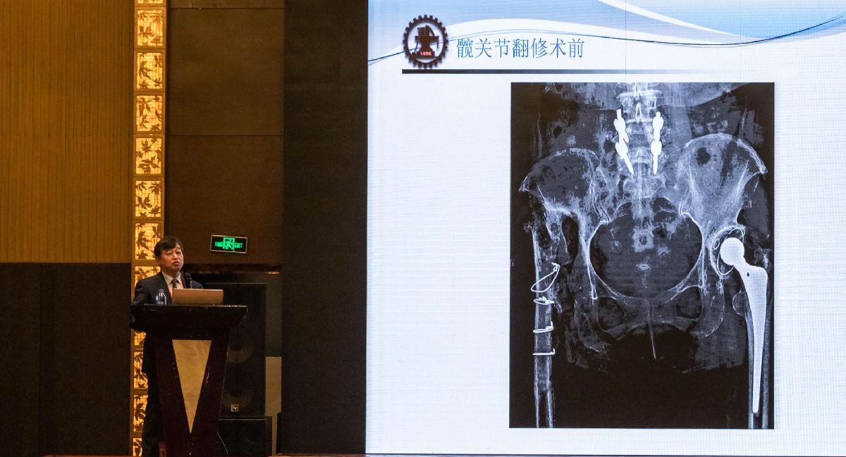 我院举办2019年福建省关节外科新进展学习班 ——特聘教授王坤正来访并做学术交流 我院举办2019年福建省关节外科新进展学习班 ——特聘教授王坤正来访并做学术交流