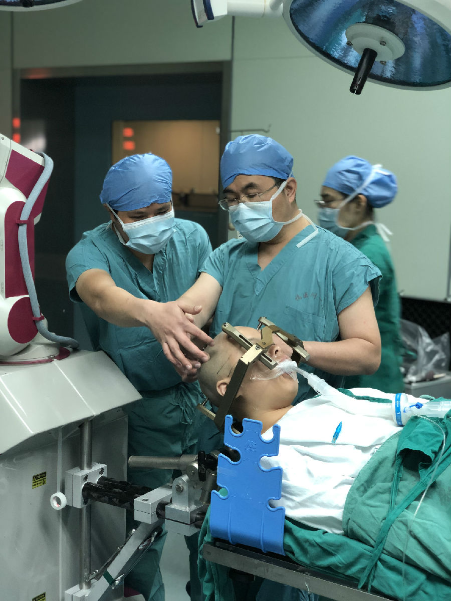 全国首例！我院利用国际新技术ROSA机器人 植入丘脑前核脑起搏器电极治疗癫痫