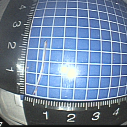 一根“流浪”的鱼刺，一场多学科协作的搜寻 ——我院采用隧道内镜技术完成食管黏膜下异物探查