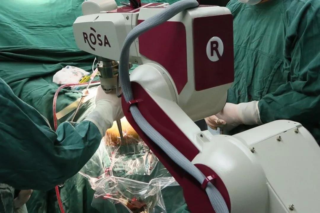 『媒体看附一』帕金森手术进入机器人时代