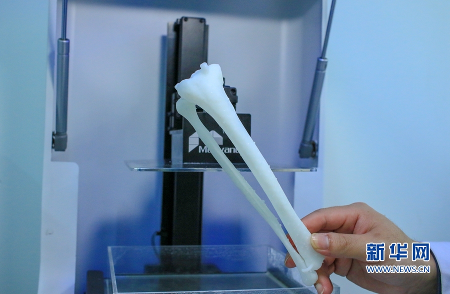 骨科临床“黑科技”：3D打印技术让手术更轻松