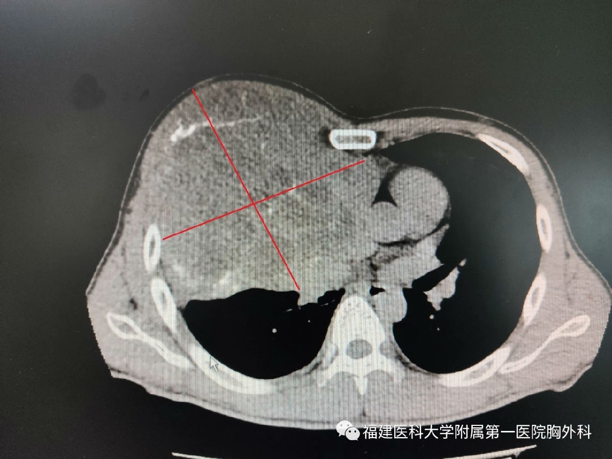 “拆弹”专家的“艺术品”