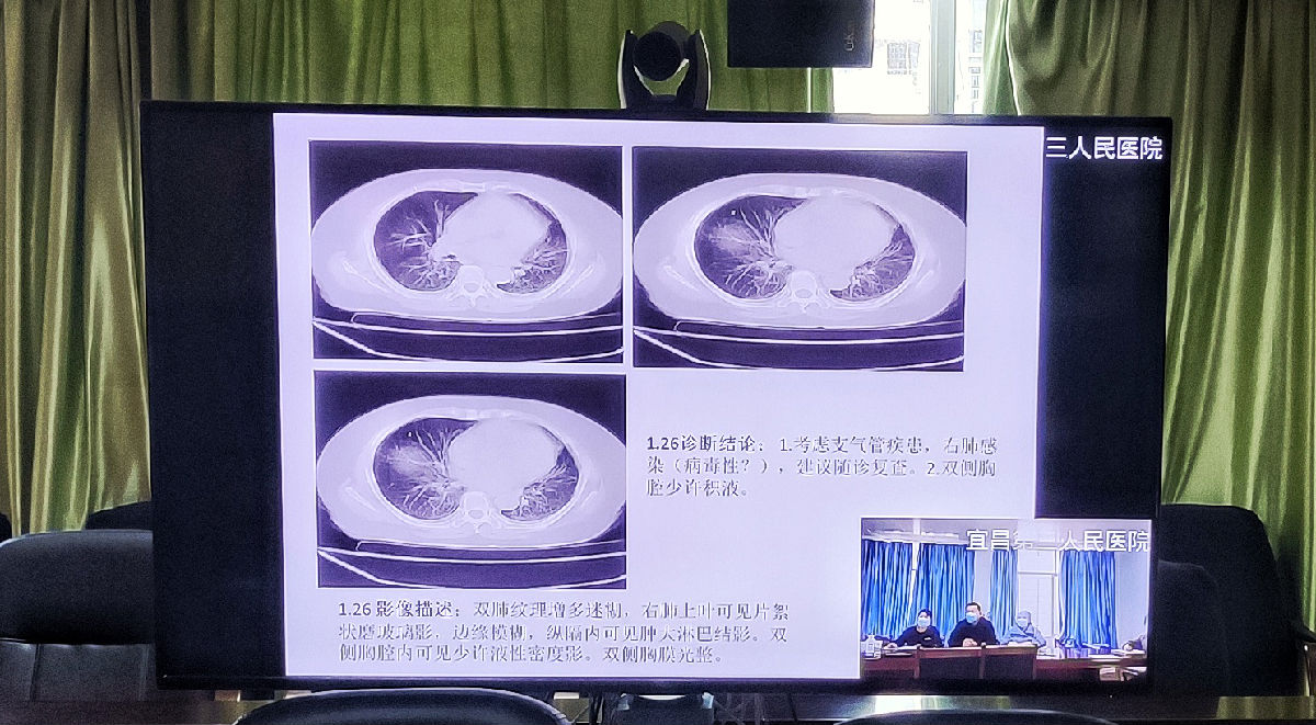 远程会诊  情系宜昌