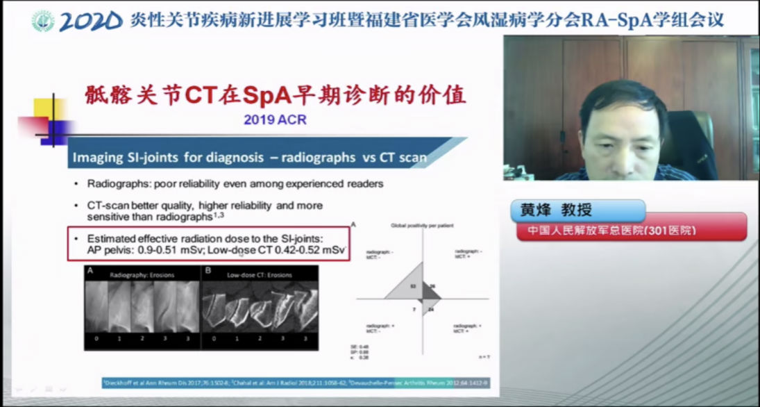 附一医院风湿免疫科举办2020炎性关节疾病新进展学习班