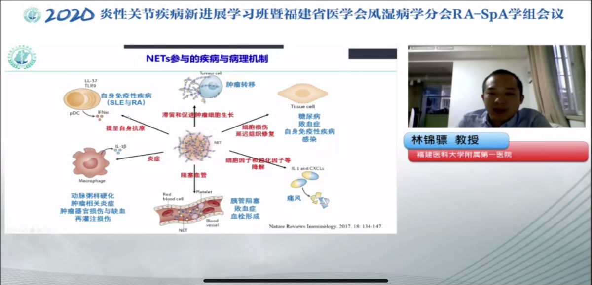 附一医院风湿免疫科举办2020炎性关节疾病新进展学习班