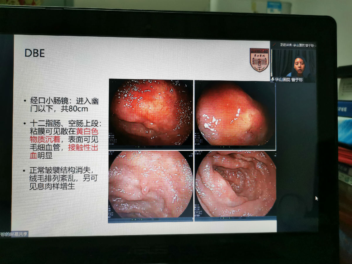 聚焦小肠疾病 尽享学术盛宴——2021华福消化论坛召开 聚焦小肠疾病 尽享学术盛宴——2021华福消化论坛召开